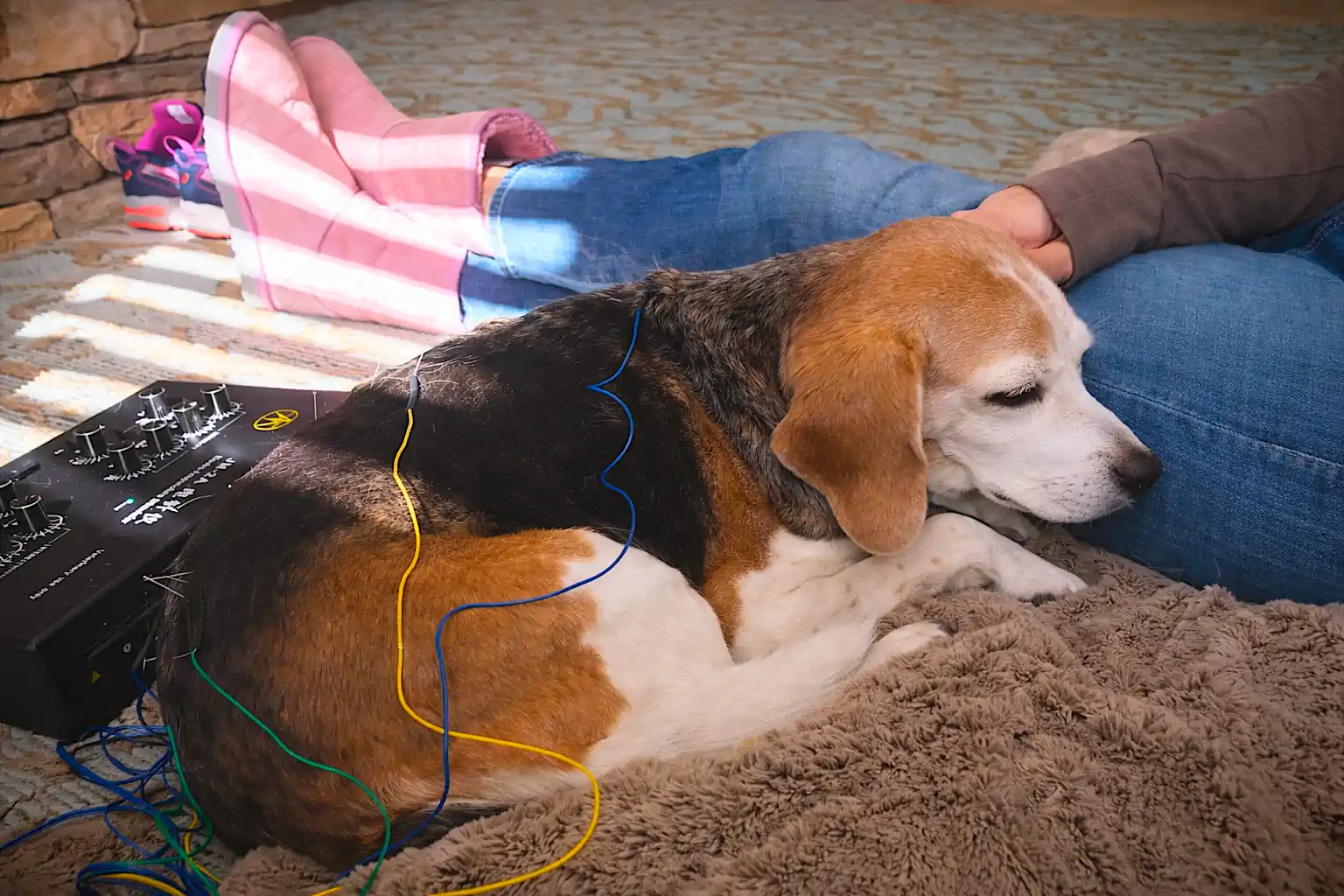 Acupuncture